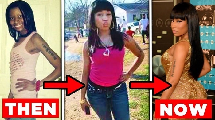 Nicki Minaj Buttocks Implants Are Real – Before and After Pictures